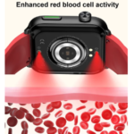 Laser Therapy Health Smart Watch Men Uric Acid Blood Sugar Watch Smart Bluetooth Call Blood Lipid Blood Pressure Smartwatch 2023